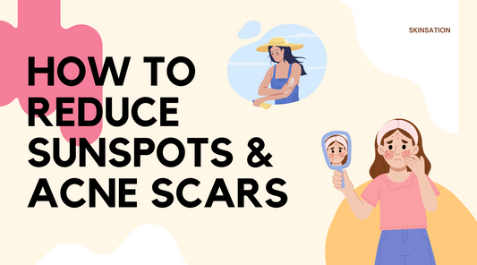 How To Reduce Sunspots & Acne Scars